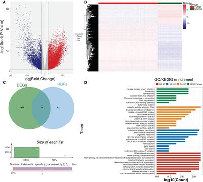 Establishment of a risk model correlated with metabolism based on RNA-binding proteins associated with cell pyroptosis in acute myeloid leukemia